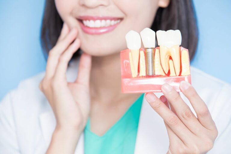 The Benefits of Dental Implants for a Healthy and Beautiful Smile